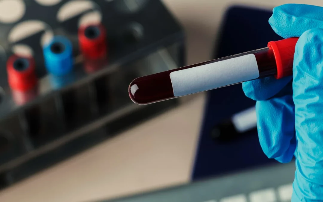 The Role of Early Characterization Studies in the Assessment of Advanced Therapeutic Potency