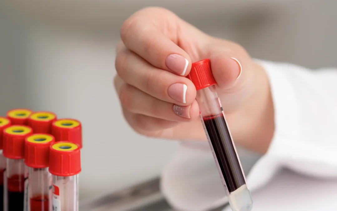 Monitoring Cord Blood Inventory Reliability by Key Quality Indicators at and After Release