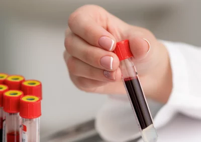 Monitoring Cord Blood Inventory Reliability by Key Quality Indicators at and After Release