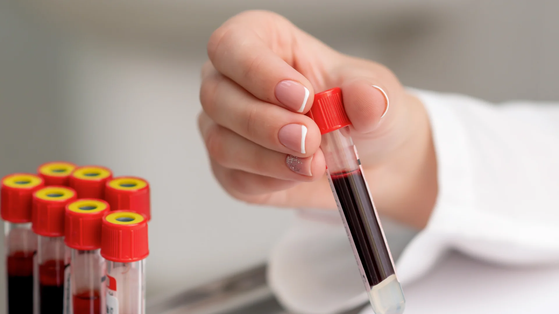 Monitoring Cord Blood Inventory Reliability by Key Quality Indicators at and After Release