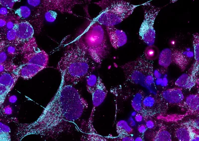 Characterizing Starting Materials for Cell and Gene Therapy Development