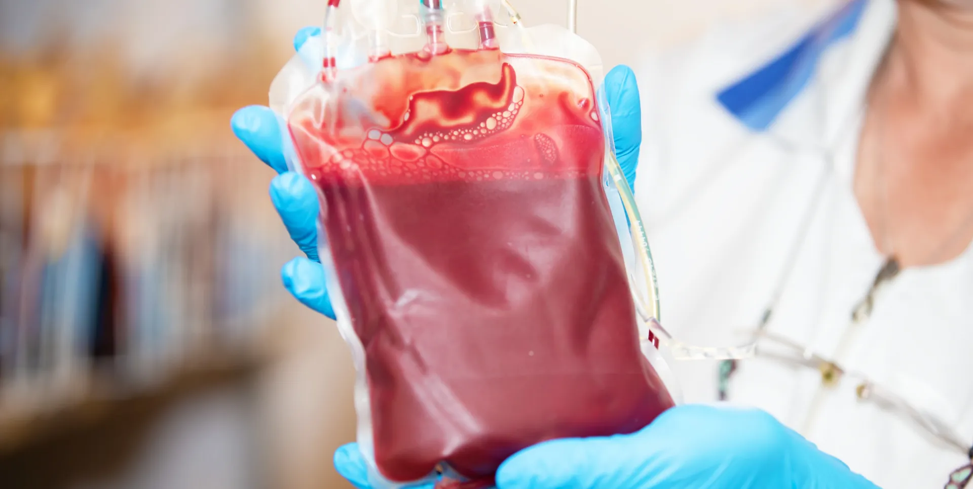 Cell-Sourcing-Apheresis-1